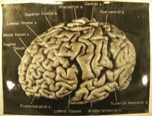 This is really Einstein's brain. Controversial posting!